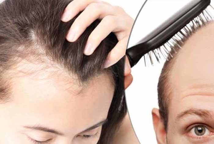 alopecia types symptoms causes treatment