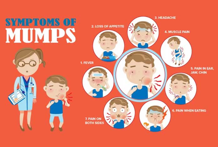 Types and Symptoms of Mumps 