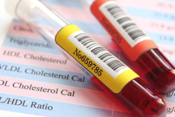 All You Need To Know About Triglycerides