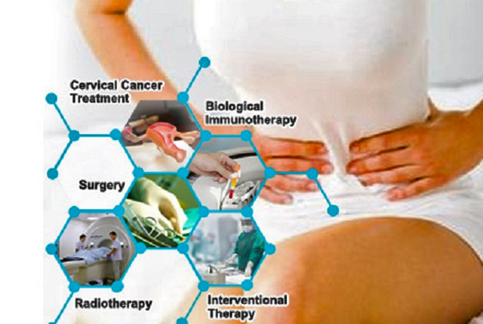 Treatment and Care of Cervical Cancer