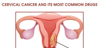 Cervical Cancer and its Most Common Drug List