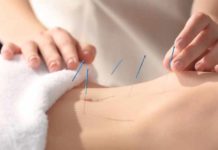acupuncture doesnt boost fertility a study finds