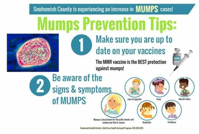 causes and prevention of mumps
