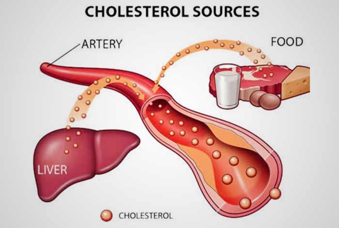 Image result for liver cholesterol