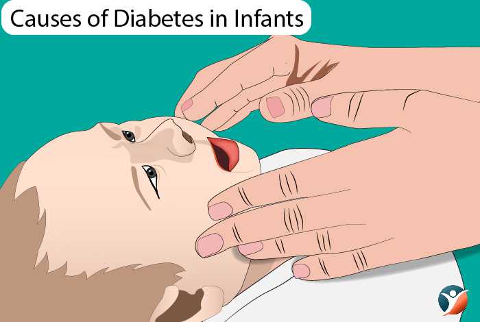 Causes of diabetes in infants 