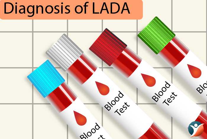 diagnosis of LADA