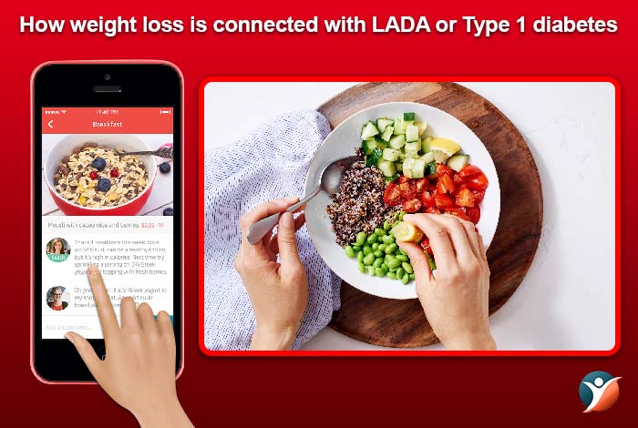 weight loss and type 1 diabetes or LADA