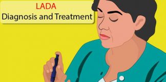 LADA diagnosis and treatment