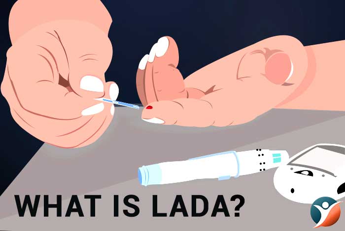 what is LADA