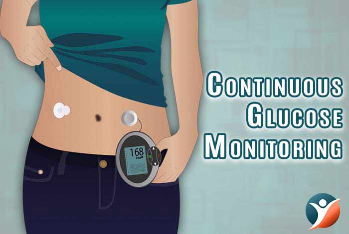 continuous glucose monitoring for diabetes