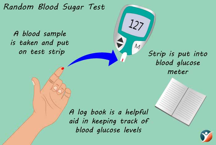 random blood sugar test for diabetes