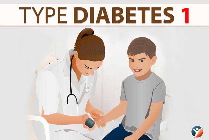 Blood sugar test for type 1 diabetes