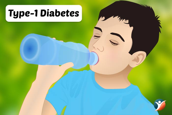 type 1 diabetes in children 