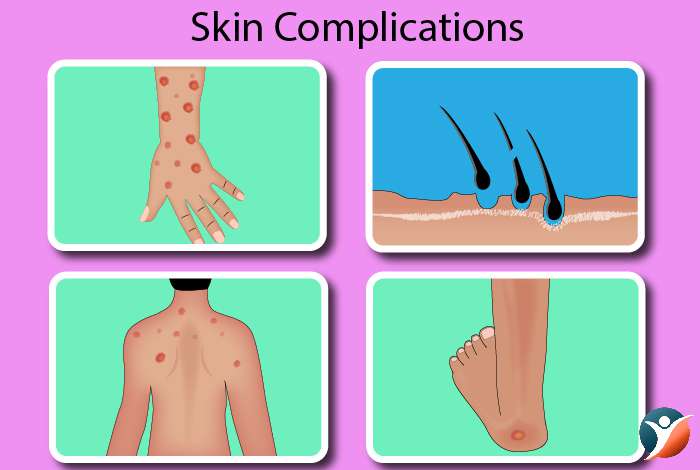 Skin Complications