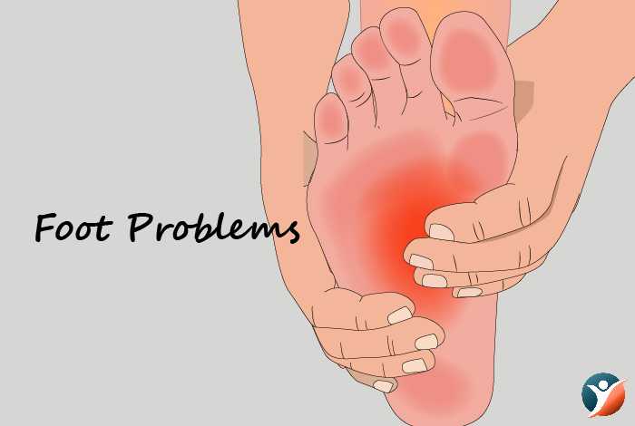 foot problems in diabetes
