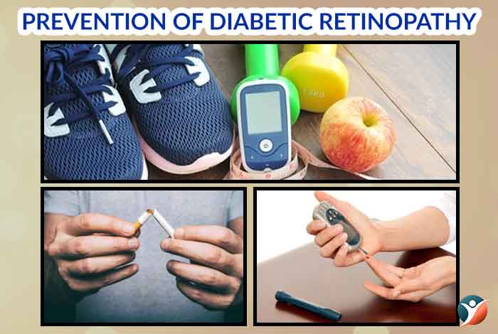 prevention of diabetes retinopathy