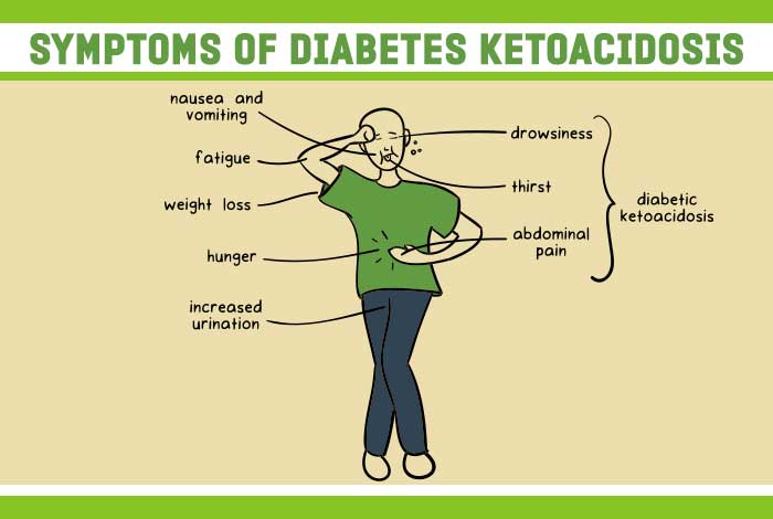diabetes ketoacidosis symptoms 