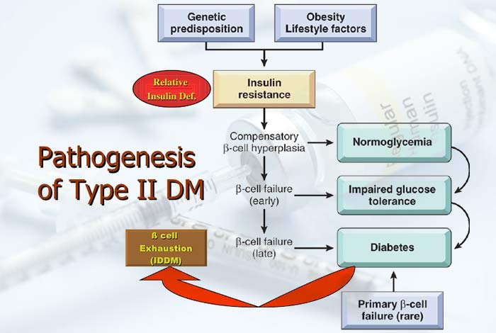 Pathogenesis of Type II Diabetes