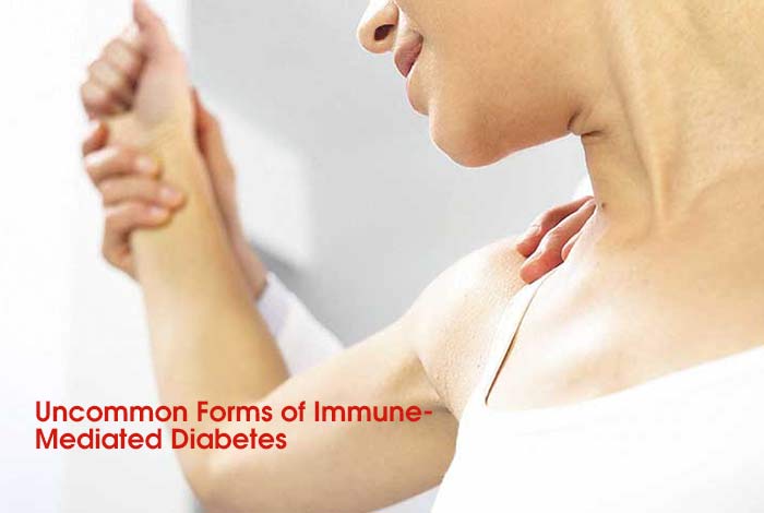 Uncommon Forms of Immune-Mediated Diabetes
