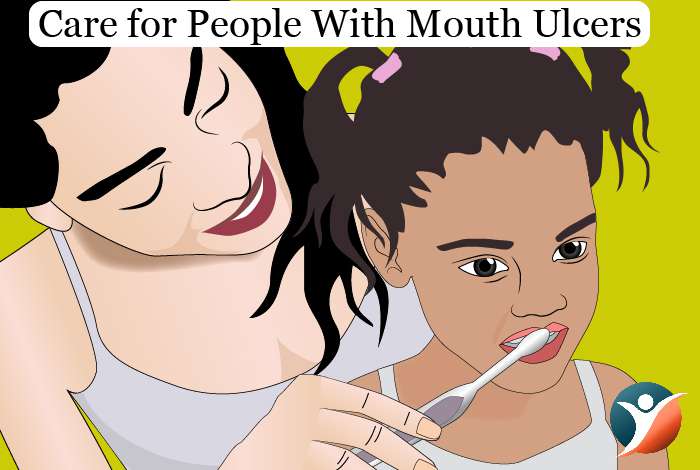 Care for People With Mouth Ulcers 