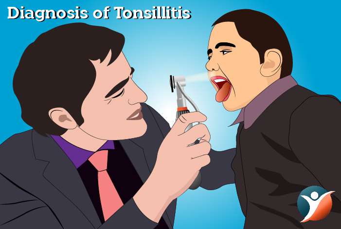 Diagnosis of Tonsillitis 