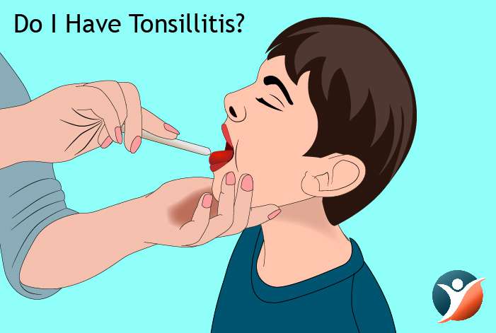 Do I Have Tonsillitis