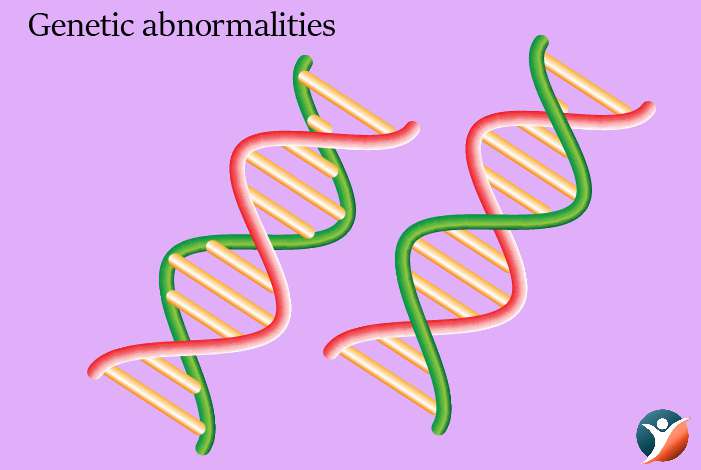 genetic abnormalities
