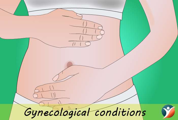 Gynecological conditions