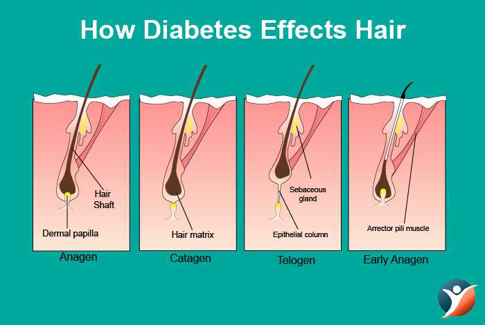How Diabetes Affects Hair Health