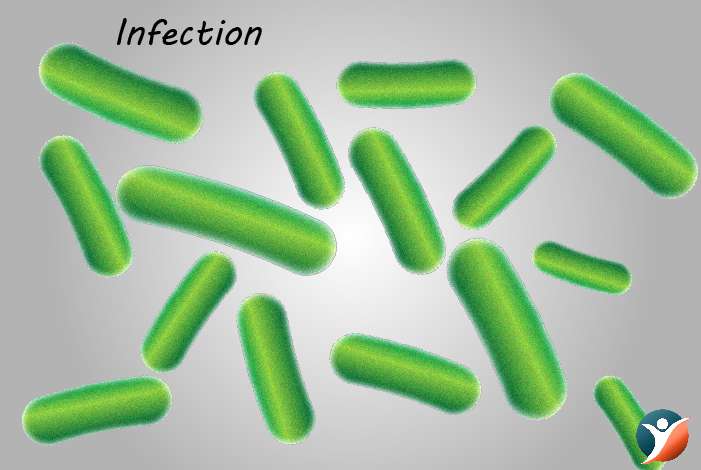  Infections
