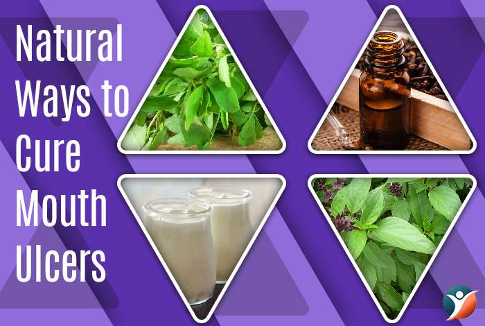 Natural Ways to Cure Mouth Ulcers