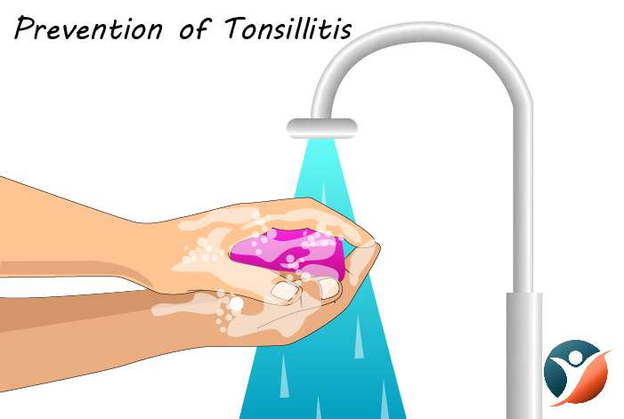 Prevention of Tonsillitis 