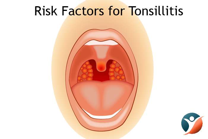 Risk Factors for Tonsillitis 