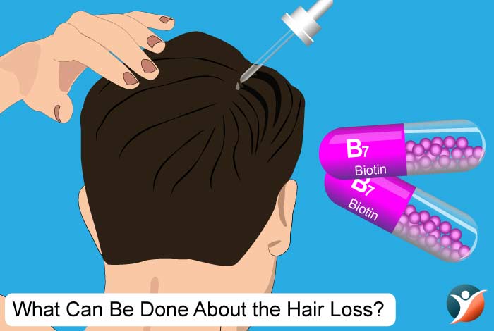 What Can Be Done to Prevent or Cure Diabetes-Related Hair Loss