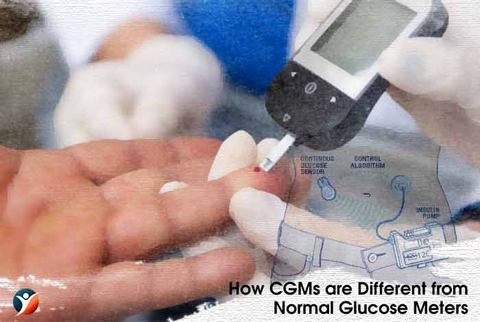 How CGMs are Different from Normal Glucose Meters?