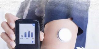 Everything You Need to Know about Continuous Glucose Monitoring System