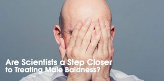 Breakthrough Trial Suggests Cure for Baldness May Be on the Way