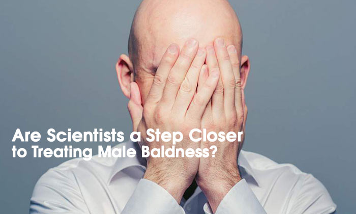 Breakthrough Trial Suggests Cure for Baldness May Be on the Way