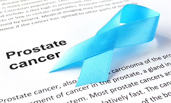 Prostate Cancer Prevention: 8 Ways to Reduce the Risk